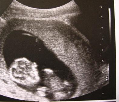 Image hébergée par Casimages.com : votre hébergeur d images simple et gratuit