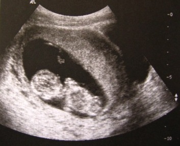 Image hébergée par Casimages.com : votre hébergeur d images simple et gratuit